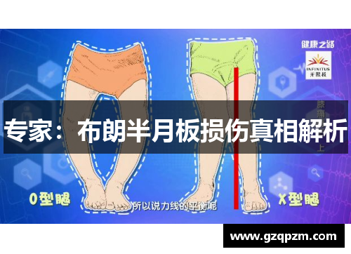专家：布朗半月板损伤真相解析